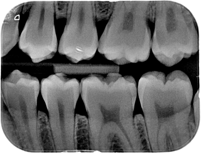 dental x ray film