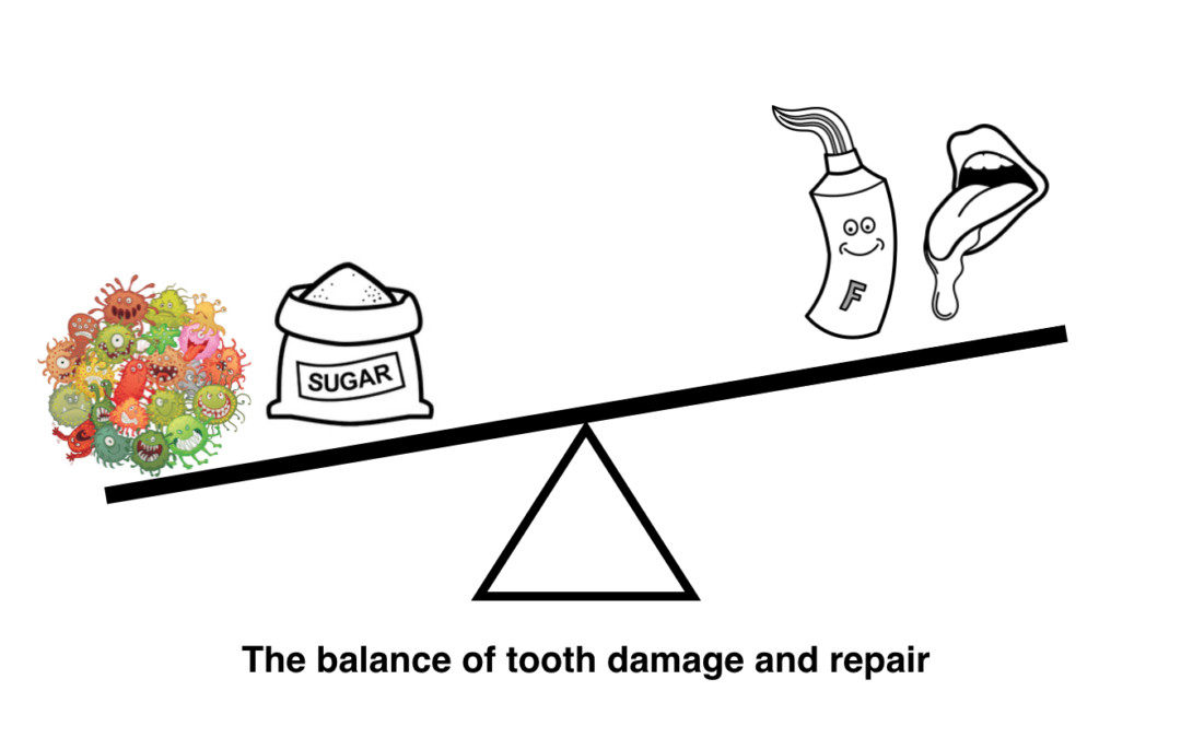 Why some people get holes in their teeth and others don’t