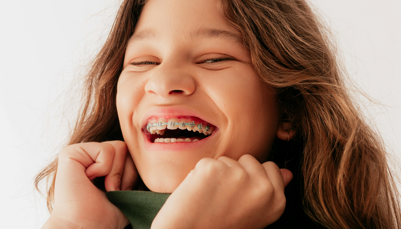 braces-vs-clear-aligners-supa-dental